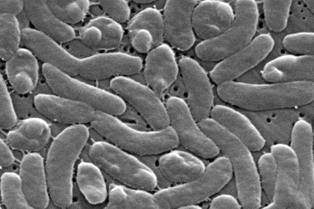Louisiana reports nine cases of Vibrio vulnificus infections this year