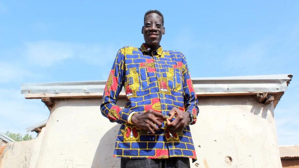 Ghanaian man with gigantism dies at 33