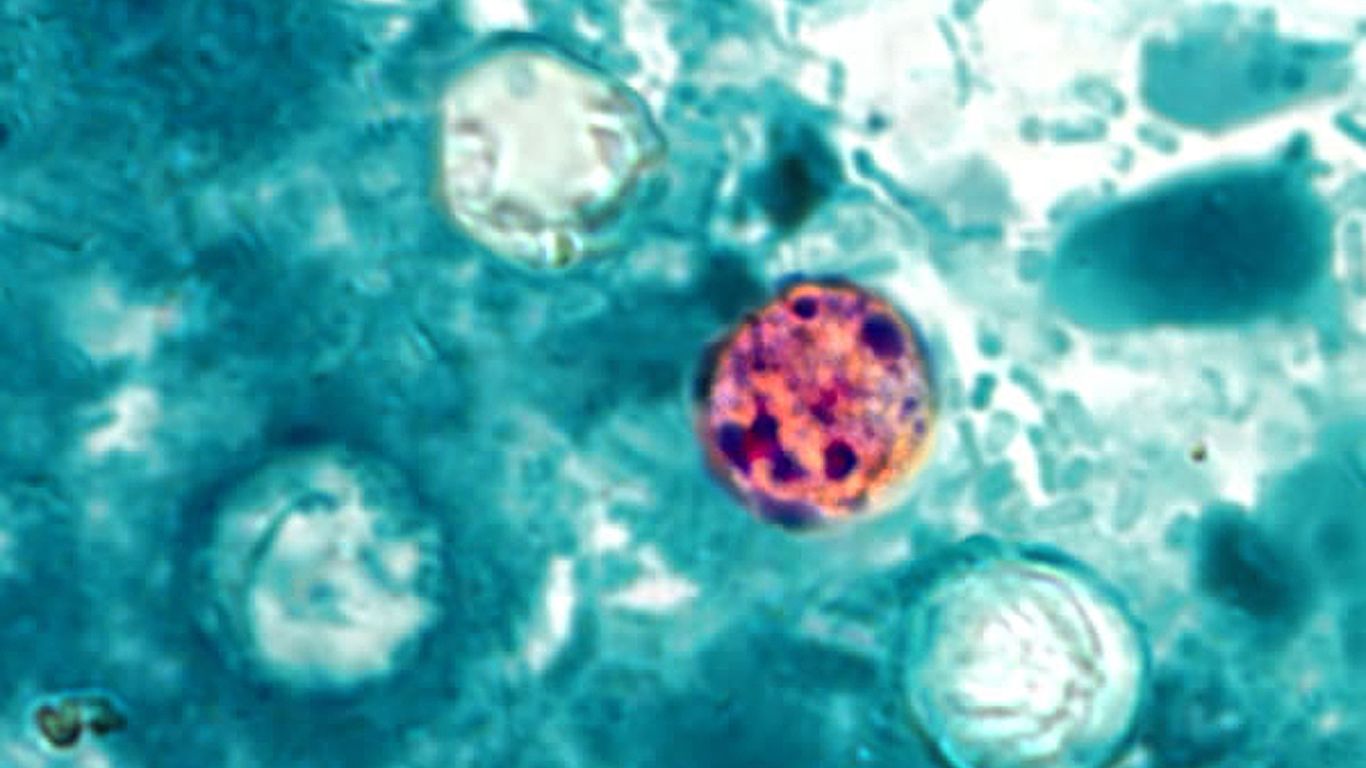 Two deaths reported in Michigan linked to cyclospora outbreak